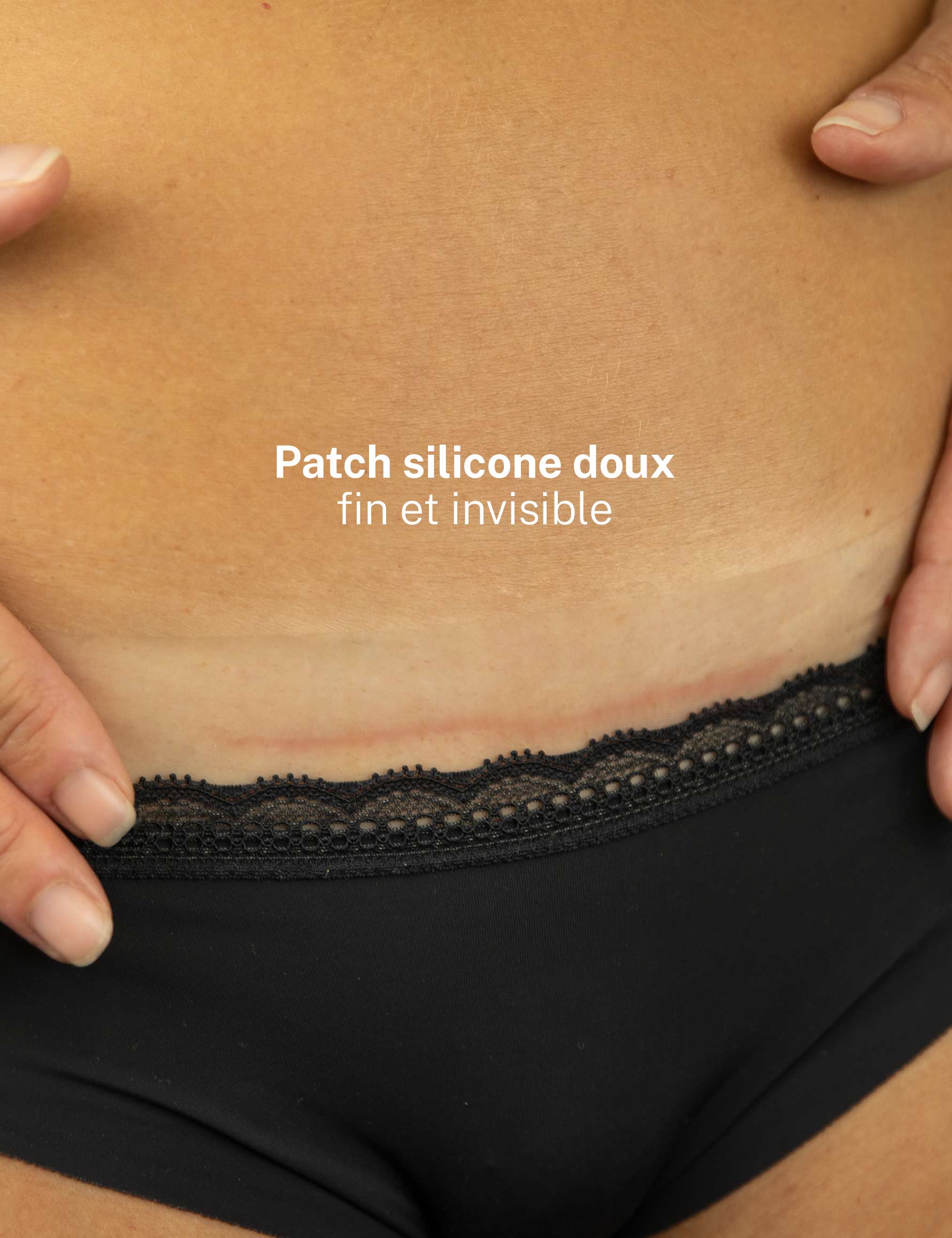 Patch médical siliconé Melicare - Image 4