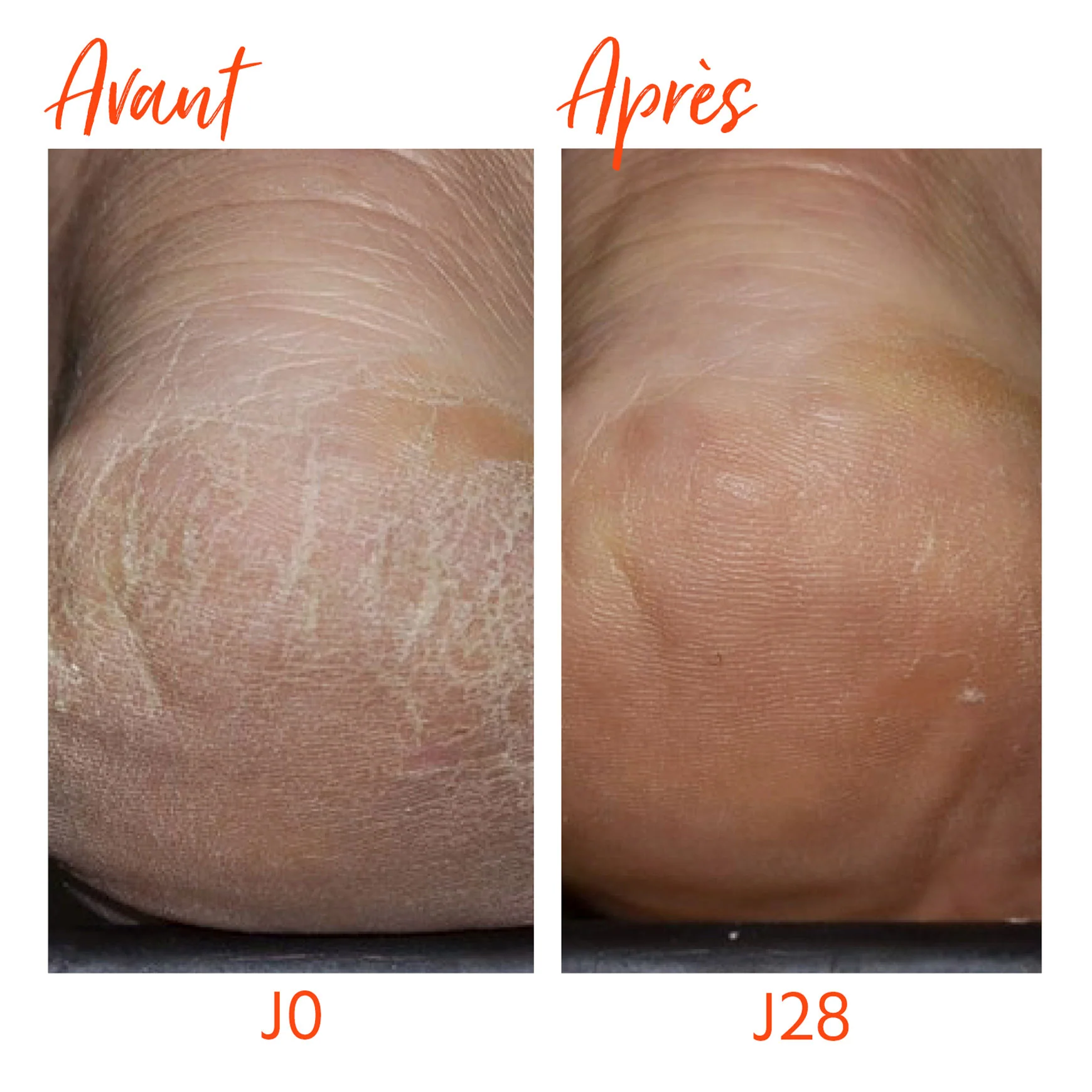 Crème Protectrice Mains & Pieds Fragilisés - Image 5